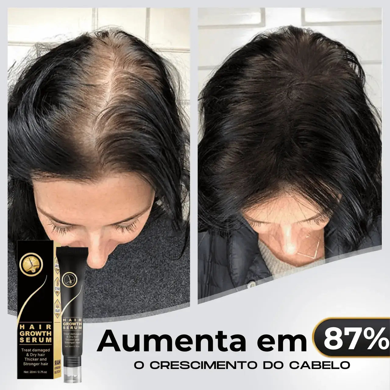 Repair Hair® | PAGUE 1 LEVE 2 - Diminua a queda de cabelos