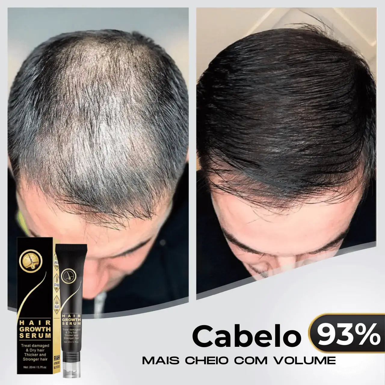 Repair Hair® | PAGUE 1 LEVE 2 - Diminua a queda de cabelos