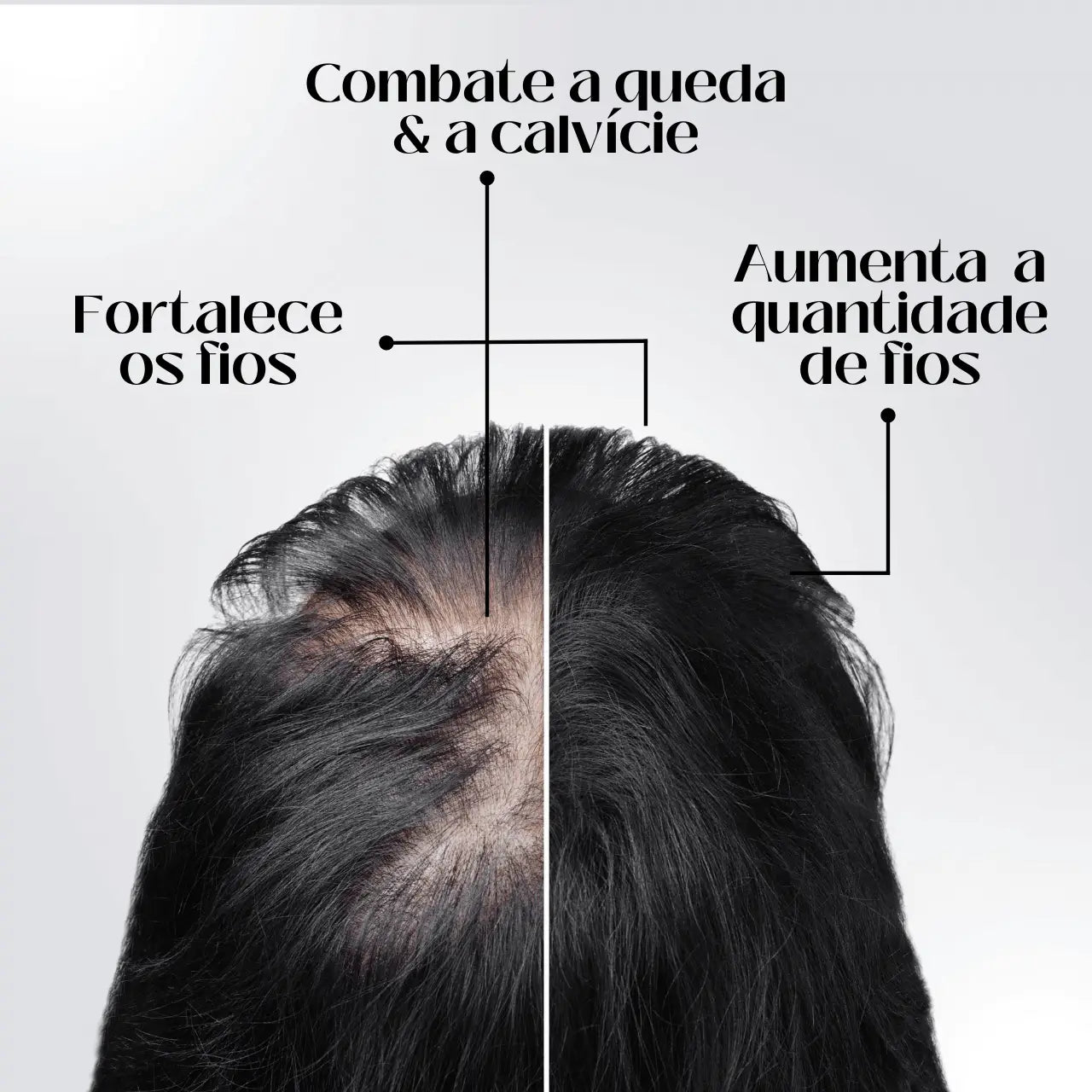 Repair Hair® | PAGUE 1 LEVE 2 - Diminua a queda de cabelos