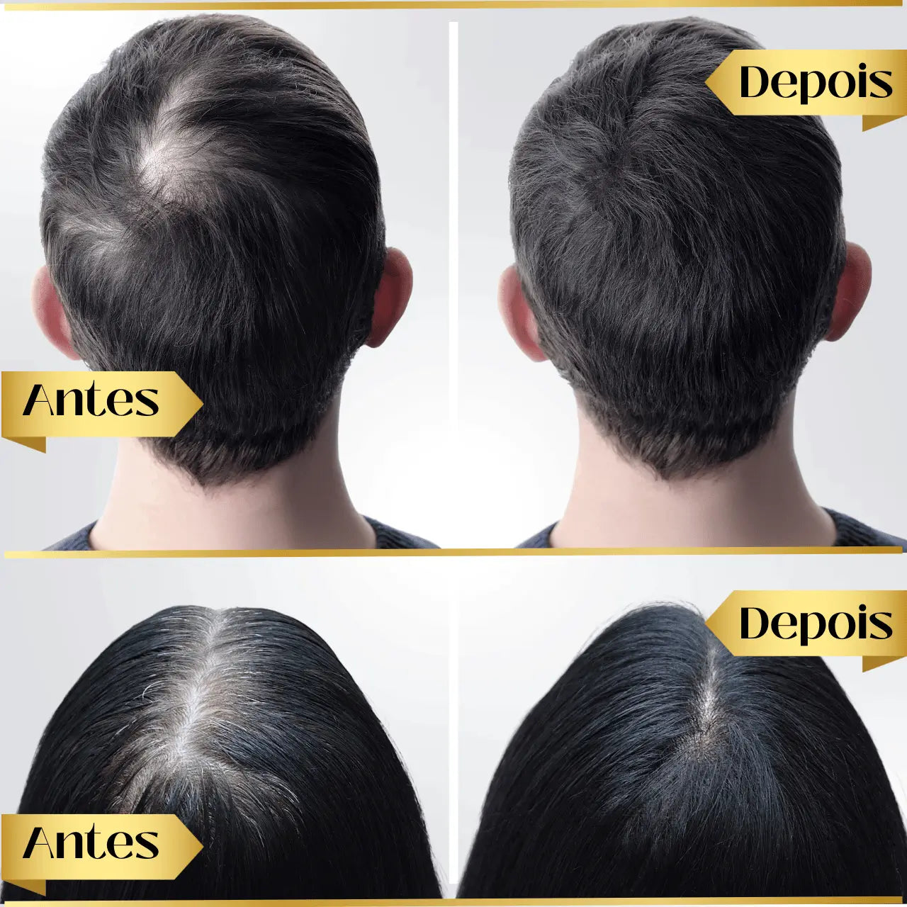 Repair Hair® | PAGUE 1 LEVE 2 - Diminua a queda de cabelos