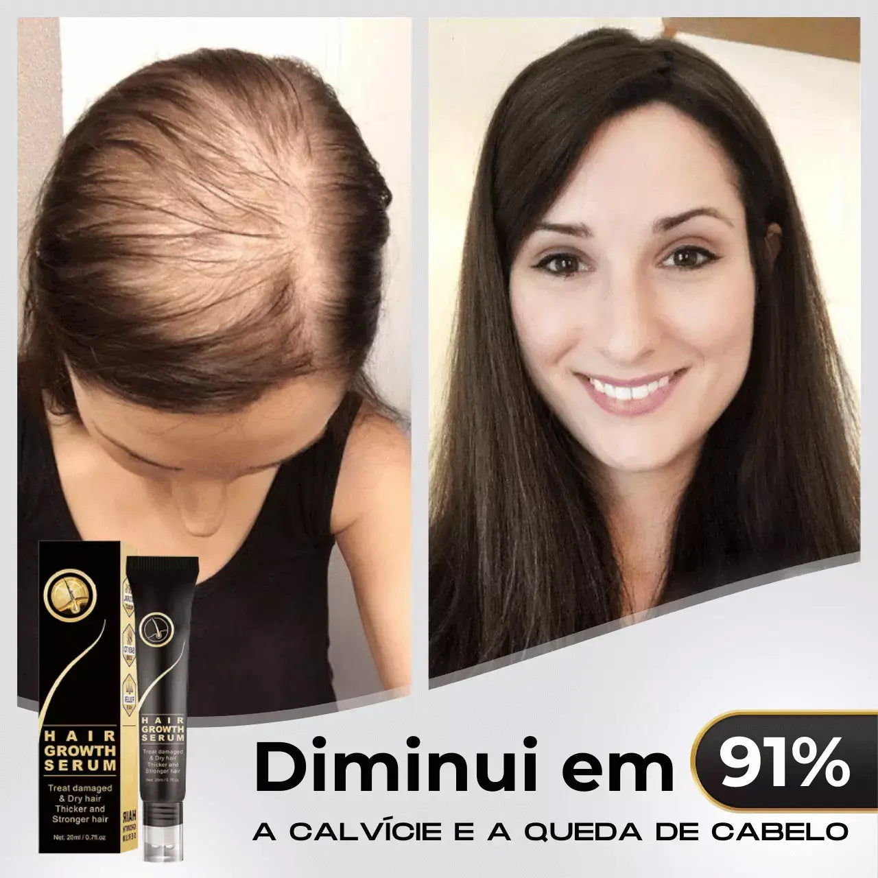 Repair Hair® | PAGUE 1 LEVE 2 - Diminua a queda de cabelos