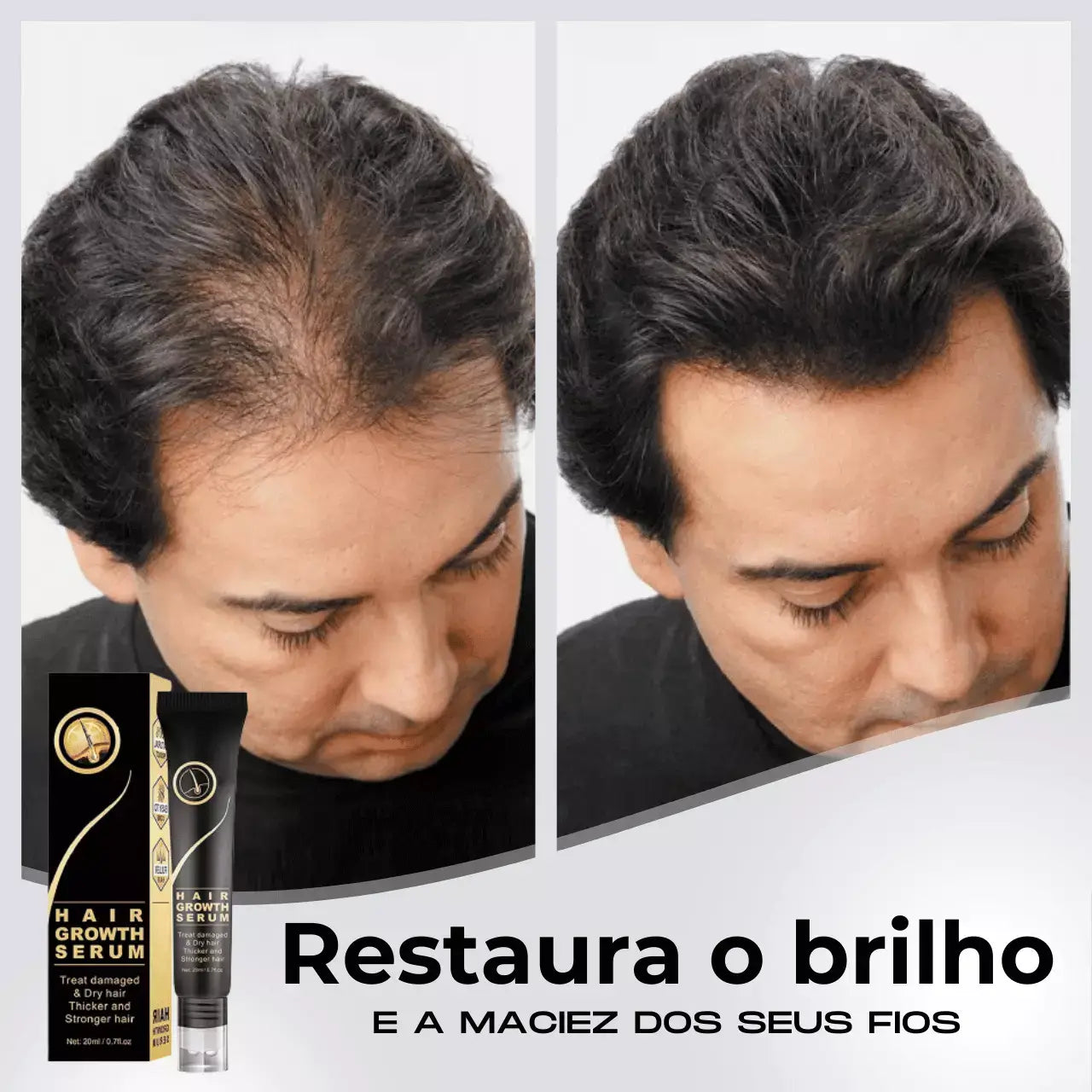 Repair Hair® | PAGUE 1 LEVE 2 - Diminua a queda de cabelos