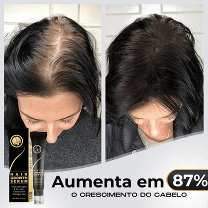 Repair Hair® | PAGUE 1 LEVE 2 - Diminua a queda de cabelos