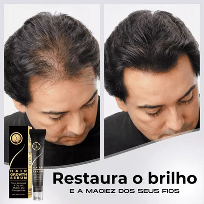 Repair Hair® | PAGUE 1 LEVE 2 - Diminua a queda de cabelos